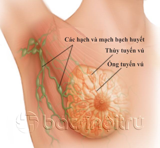 Các giai đoạn của ung thư vú